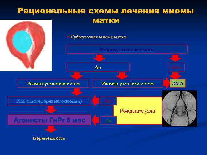 Рациональные схемы лечения миомы матки § Субмукозная миома матки Репродуктивные планы Да Размер узла