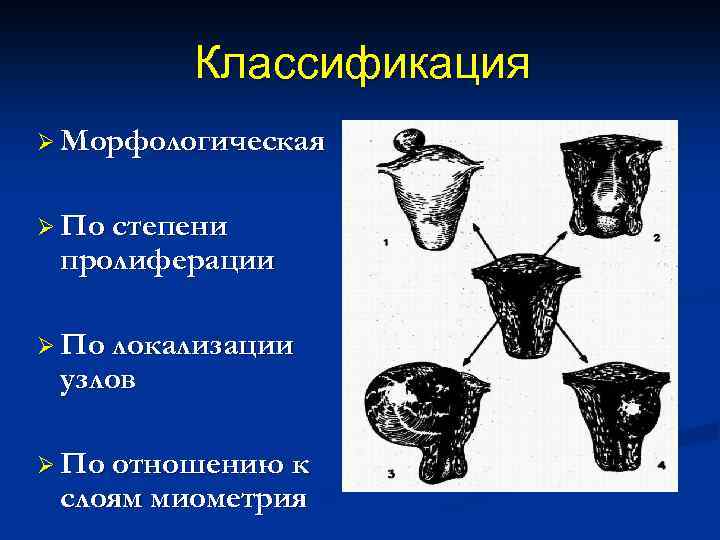 Классификация Ø Морфологическая Ø По степени пролиферации Ø По локализации узлов Ø По отношению