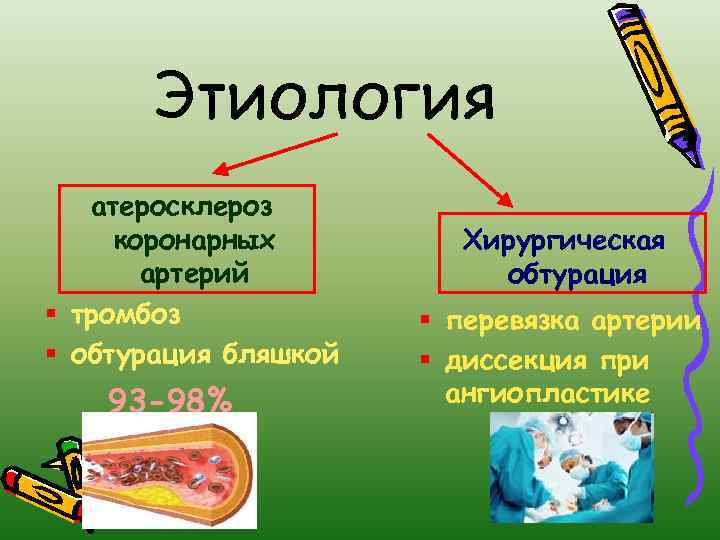 Этиология атеросклероз коронарных артерий § тромбоз § обтурация бляшкой 93 -98% % Хирургическая обтурация