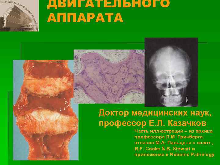 ДВИГАТЕЛЬНОГО АППАРАТА Доктор медицинских наук, профессор Е. Л. Казачков Часть иллюстраций – из архива