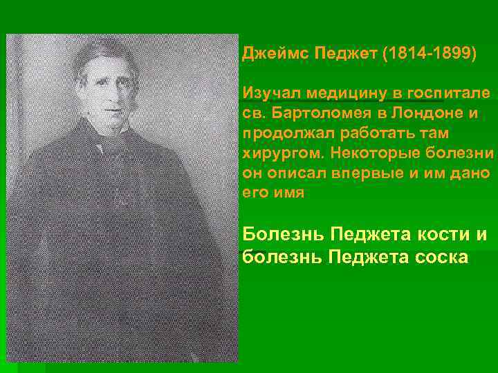 Джеймс Педжет (1814 -1899) Изучал медицину в госпитале св. Бартоломея в Лондоне и продолжал