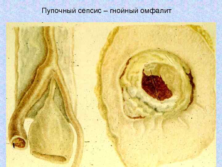 Как выглядит омфалит фото