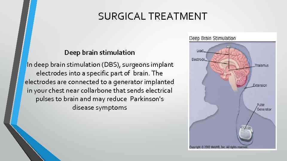 SURGICAL TREATMENT Deep brain stimulation In deep brain stimulation (DBS), surgeons implant electrodes into