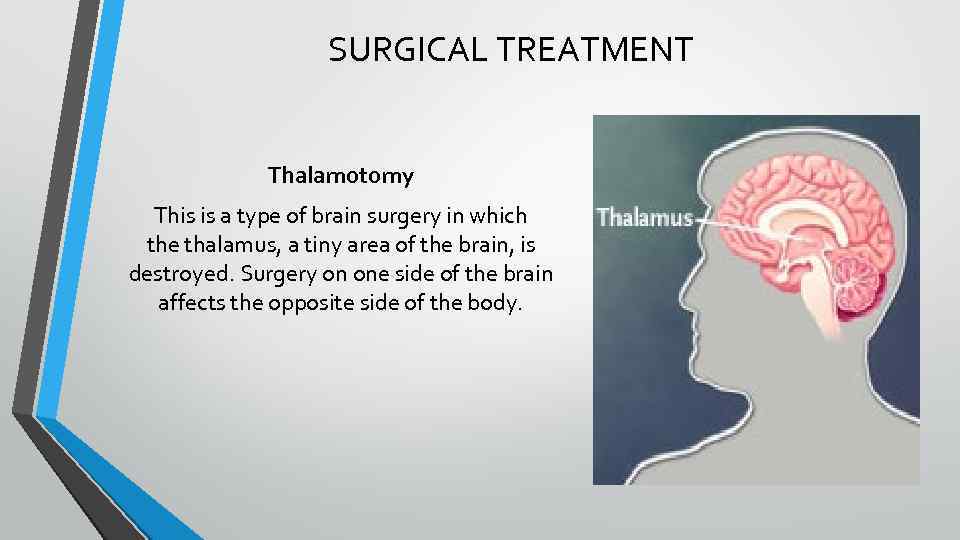 SURGICAL TREATMENT Thalamotomy This is a type of brain surgery in which the thalamus,