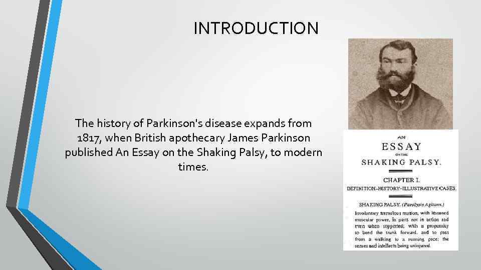 INTRODUCTION The history of Parkinson's disease expands from 1817, when British apothecary James Parkinson