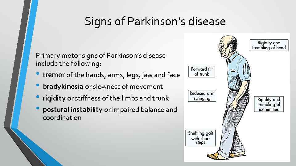 Signs of Parkinson’s disease Primary motor signs of Parkinson’s disease include the following: •