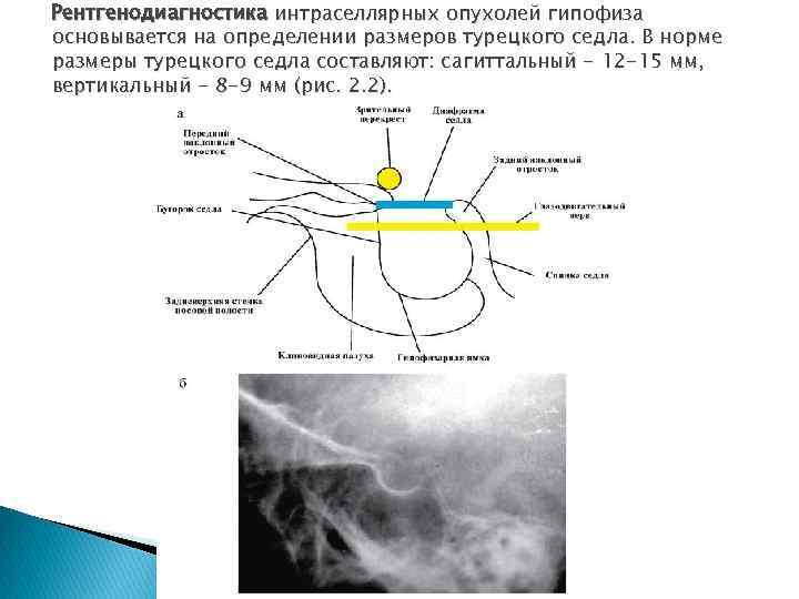 Нормы турецкого седла