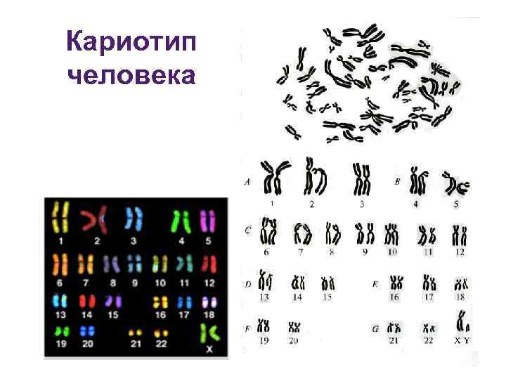 Кариотип человека определяют. Хромосомный набор кариотип человека рисунок. Кариотип кролика. Кариотип генетика.