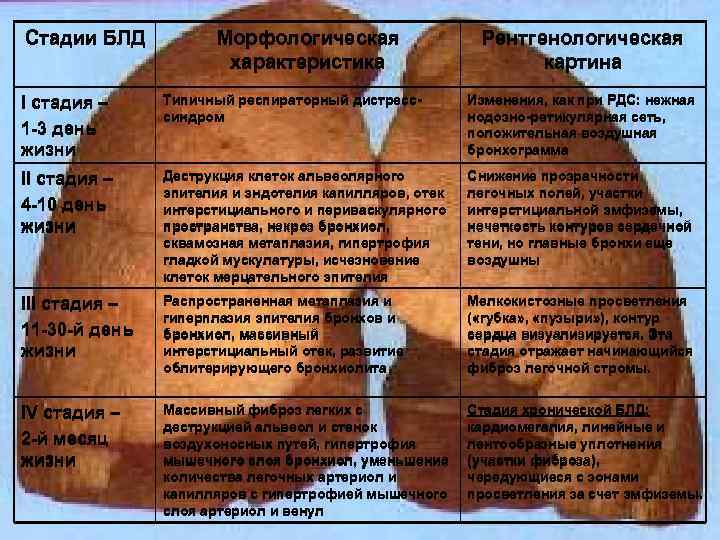 Стадии БЛД Морфологическая характеристика Рентгенологическая картина I стадия – 1 -3 день жизни Типичный