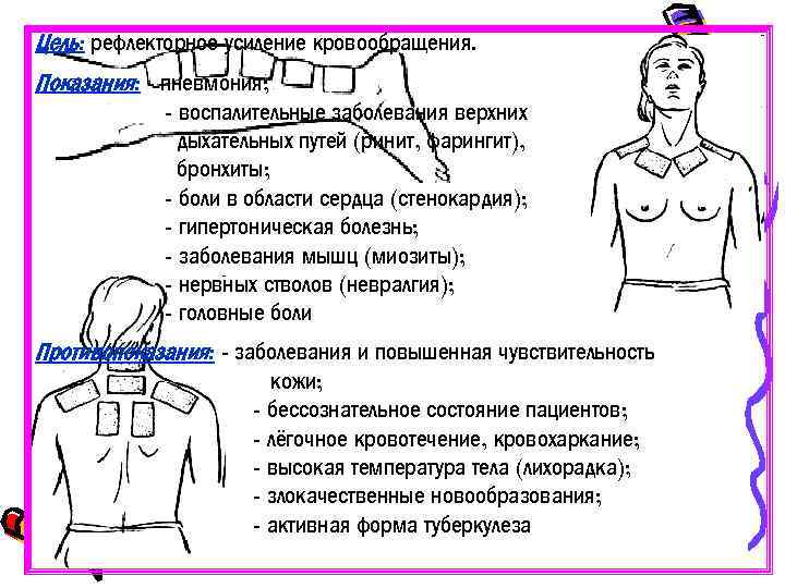 Цель: рефлекторное усиление кровообращения. Показания: - пневмония; - воспалительные заболевания верхних дыхательных путей (ринит,