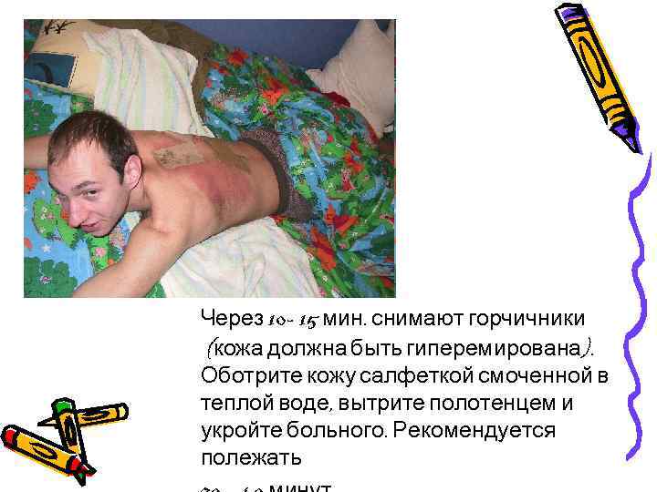 Через 10 - 15 мин. снимают горчичники (кожа должна быть гиперемирована). Оботрите кожу салфеткой