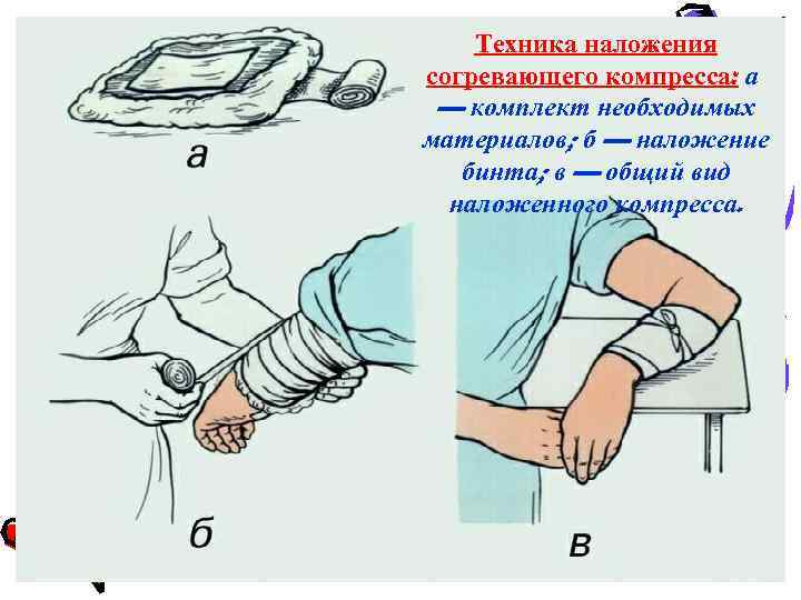 Техника наложения. Наложение термоизолирующей повязки алгоритм. Термоизолирующая повязка при обморожении алгоритм. Асептическая термоизолирующая повязка. Техника наложения термоизолирующей повязки.
