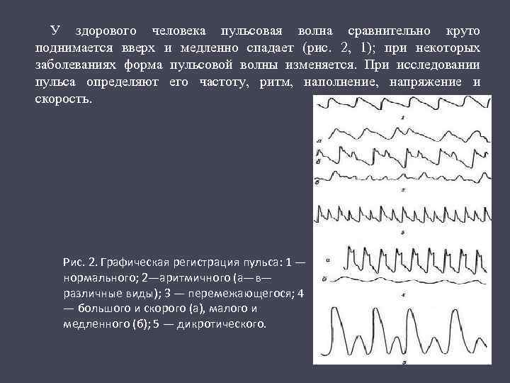 Равномерный пульс. Пульсоксиметр график пульсовой волны. Схема формирования пульсовой волны. Форма пульсовой волны. Виды пульсовой волны.