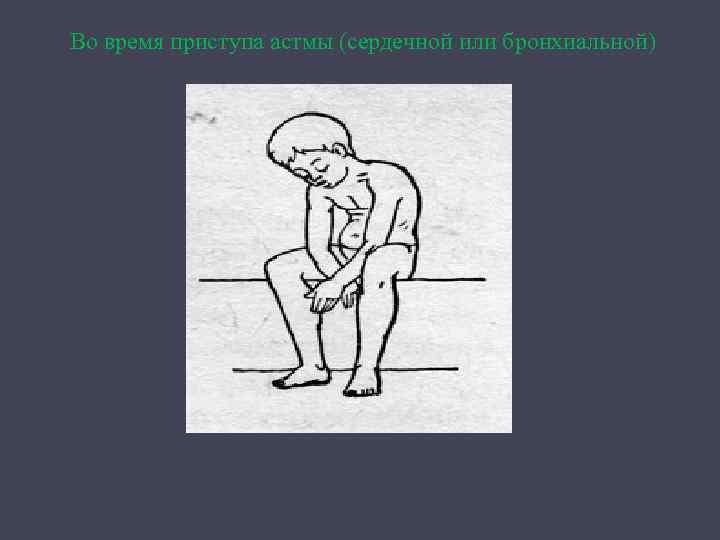 Во время приступа астмы (сердечной или бронхиальной) 