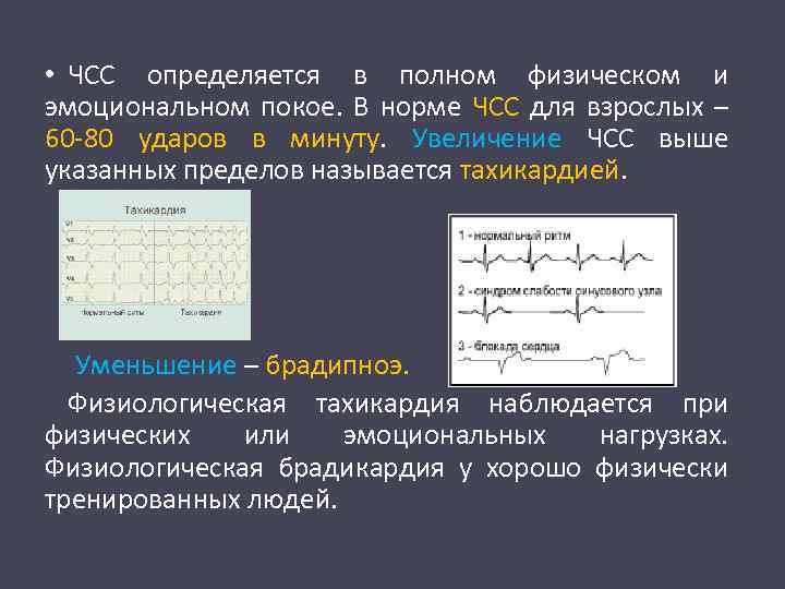  • ЧСС определяется в полном физическом и эмоциональном покое. В норме ЧСС для