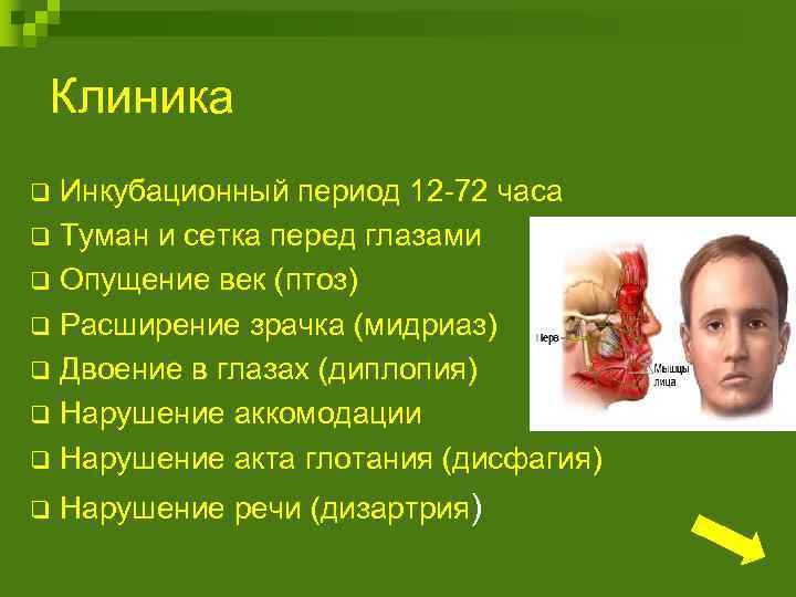 Клиника Инкубационный период 12 -72 часа q Туман и сетка перед глазами q Опущение