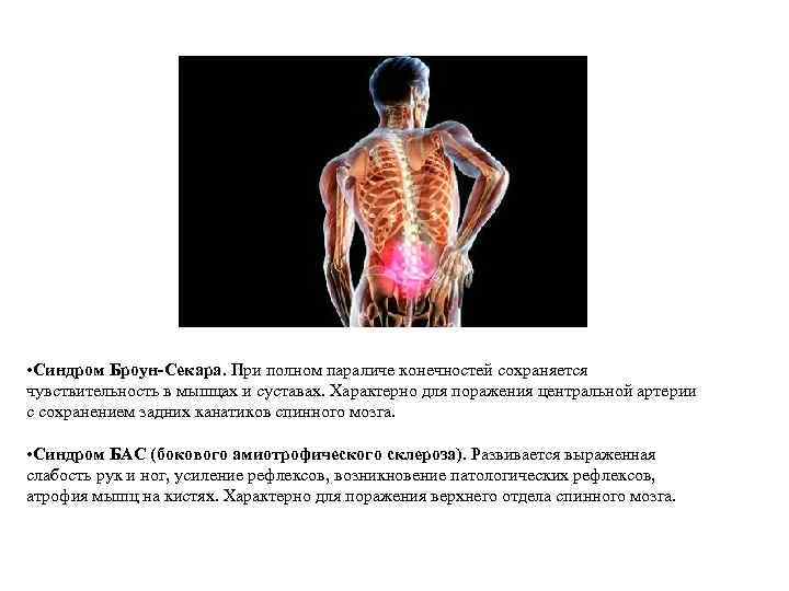  • Синдром Броун-Секара. При полном параличе конечностей сохраняется чувствительность в мышцах и суставах.