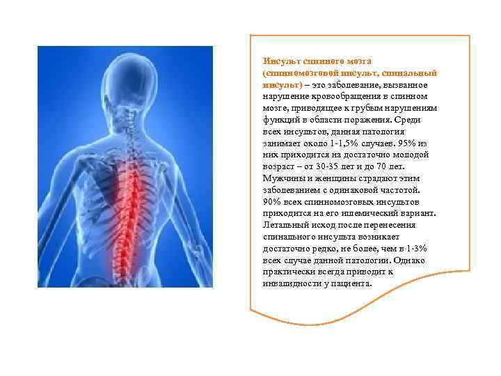 Инсульт спинного мозга (спинномозговой инсульт, спинальный инсульт) – это заболевание, вызванное нарушение кровообращения в