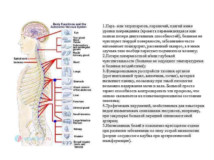 1. Пара- или тетрапарезов, параличей, плегий ниже уровня повреждения (хромота перемежающаяся или полная потеря
