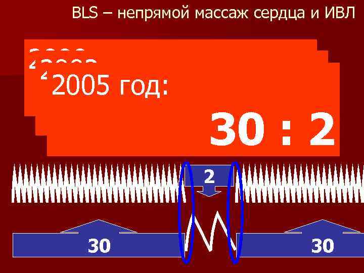 BLS – непрямой массаж сердца и ИВЛ 2000 год: 2003 год: 2005 год: 5