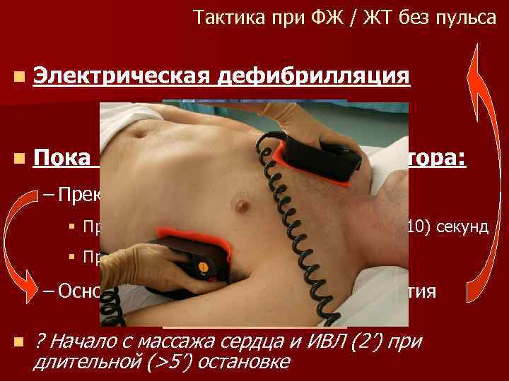 Тактика при ФЖ / ЖТ без пульса n Электрическая n Пока дефибрилляция нет готового