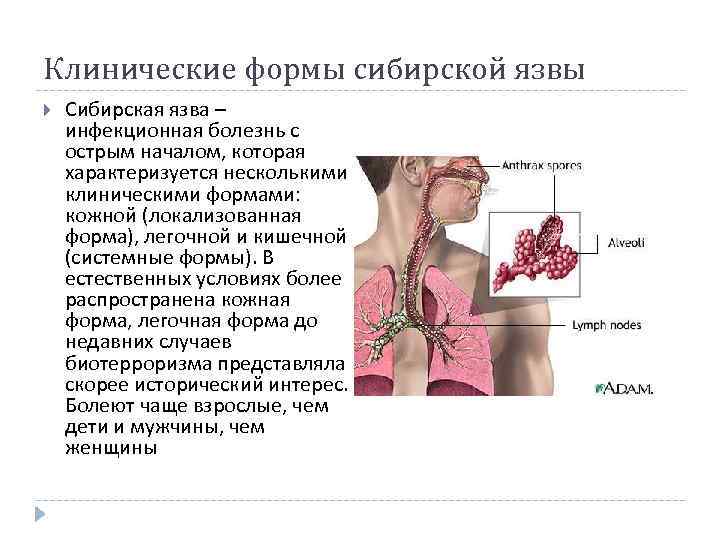 Клинические формы сибирской язвы Сибирская язва – инфекционная болезнь с острым началом, которая характеризуется