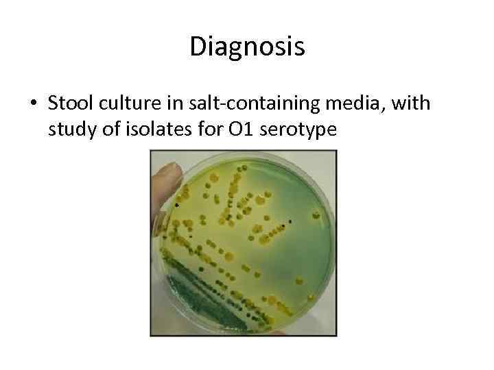 Diagnosis • Stool culture in salt-containing media, with study of isolates for O 1