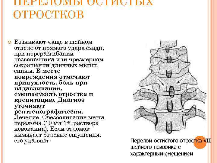 ПЕРЕЛОМЫ ОСТИСТЫХ ОТРОСТКОВ Возникают чаще в шейном отделе от прямого удара сзади, при переразгибании