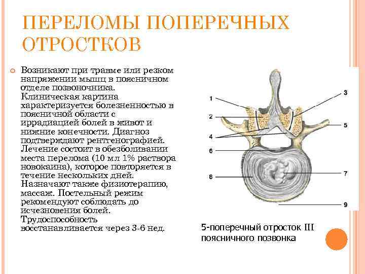 ПЕРЕЛОМЫ ПОПЕРЕЧНЫХ ОТРОСТКОВ Возникают при травме или резком напряжении мышц в поясничном отделе позвоночника.