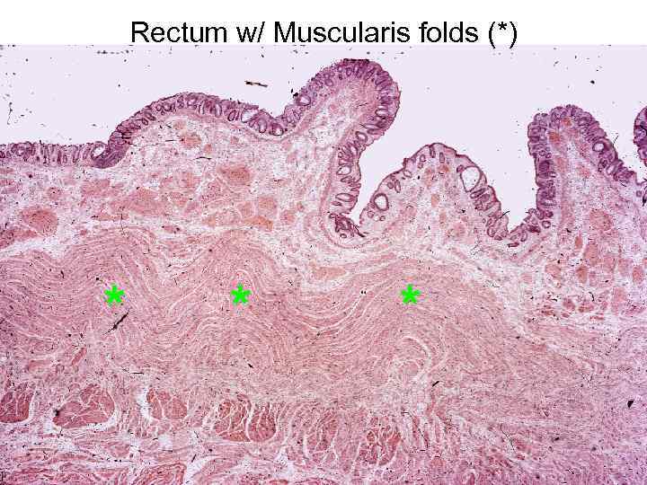 Rectum w/ Muscularis folds (*) * * * 