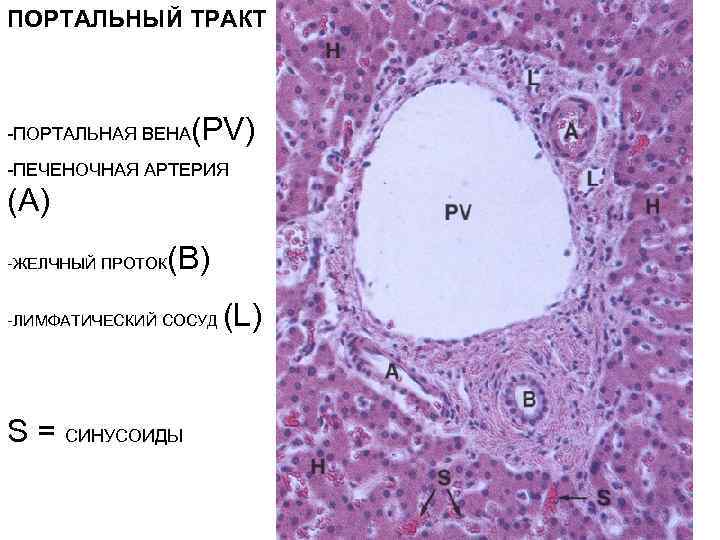 ПОРТАЛЬНЫЙ ТРАКТ -ПОРТАЛЬНАЯ ВЕНА (PV) -ПЕЧЕНОЧНАЯ АРТЕРИЯ (A) -ЖЕЛЧНЫЙ ПРОТОК (B) -ЛИМФАТИЧЕСКИЙ СОСУД S