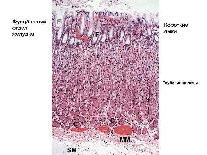 Фундальный отдел желудка Короткие ямки Глубокие железы 
