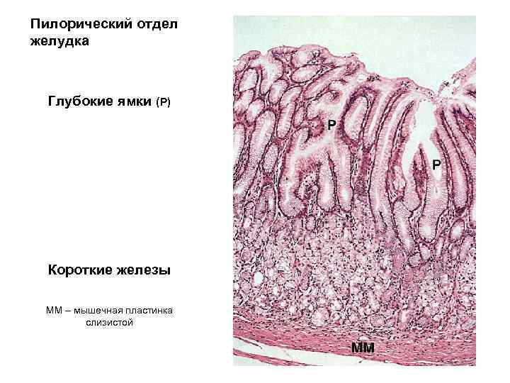 Пилорический отдел желудка Глубокие ямки (P) Короткие железы MM – мышечная пластинка слизистой 