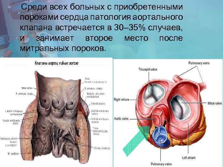 Составляющие клапана аорты