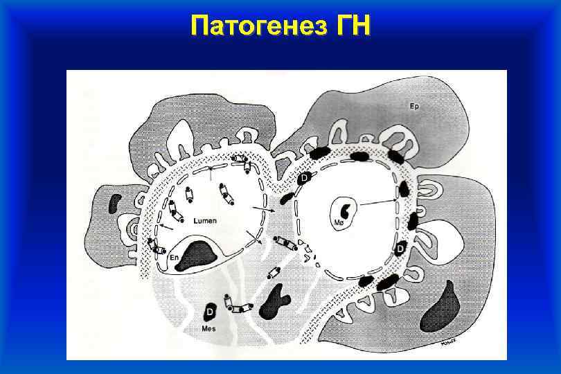 Патогенез ГН 2010 