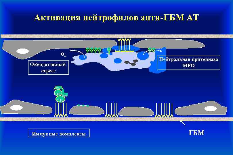 Активация нейтрофилов анти-ГБМ АТ O 2 - Оксидативный стресс Нейтральная протеиназа MPO C 2