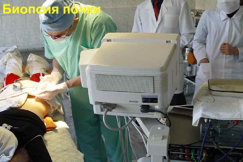 Биопсия почки 