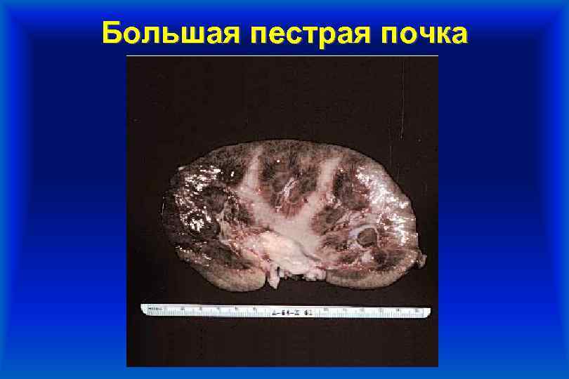 Большая пестрая почка 