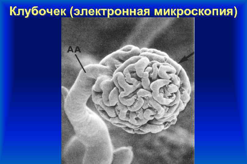 Клубочек (электронная микроскопия) 