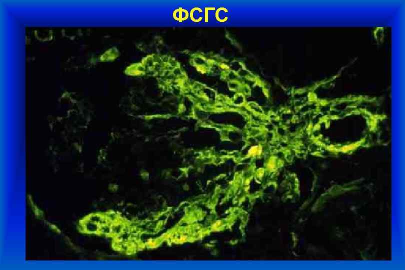 ФСГС 