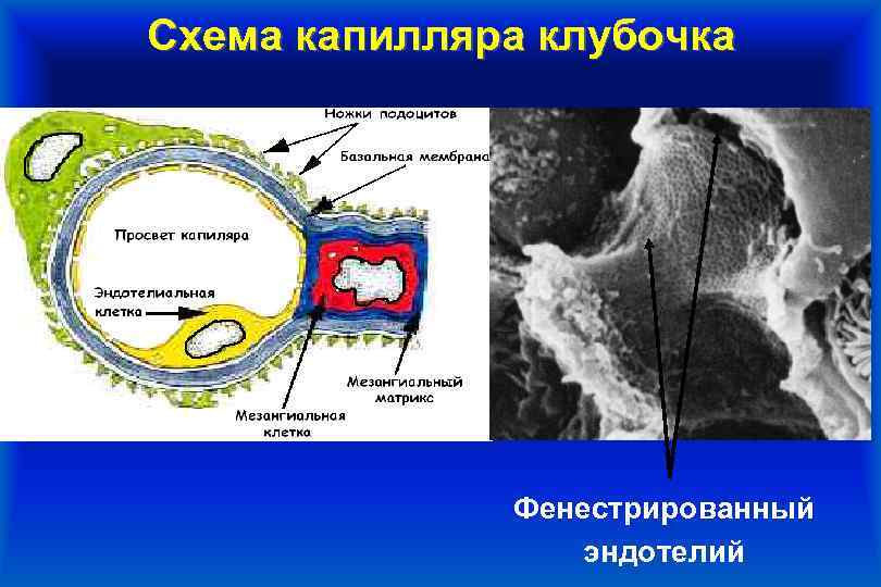 Схема капилляра клубочка Фенестрированный эндотелий 