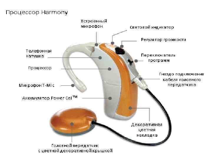 Устройство кохлеарного импланта. Кохлеарный имплант строение. Кохлеарный имплант состоит из. Кохлеарный имплантат из чего состоит. Кохлеарный имплант состоит из двух основных частей.