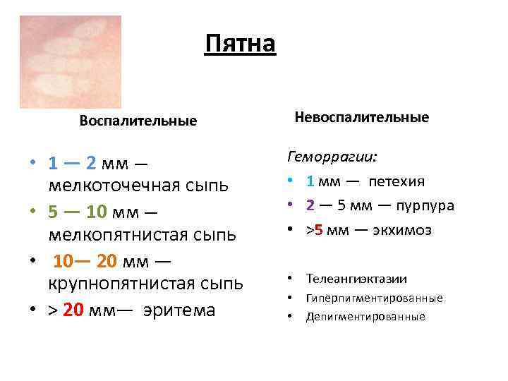 Пятна Невоспалительные Воспалительные • 1 — 2 мм — мелкоточечная сыпь • 5 —