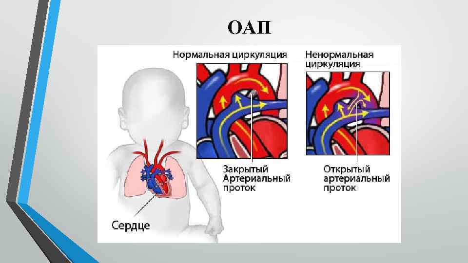 ОАП 