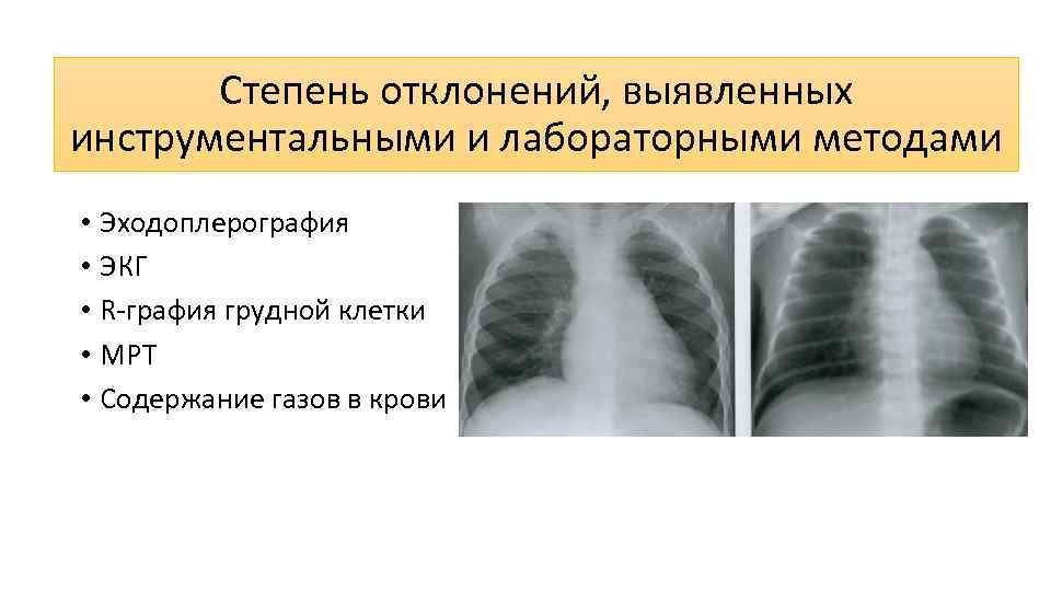 Степень отклонений, выявленных инструментальными и лабораторными методами • Эходоплерография • ЭКГ • R-графия грудной