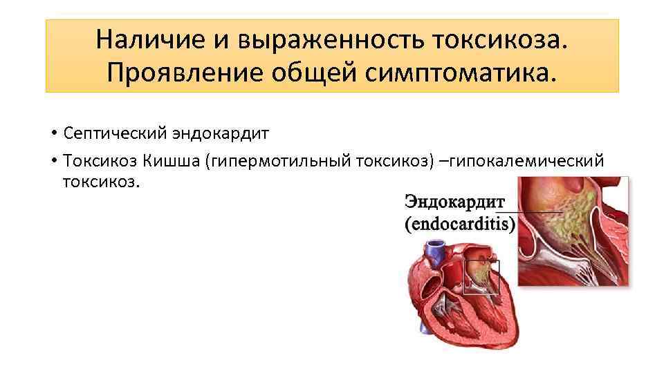 Наличие и выраженность токсикоза. Проявление общей симптоматика. • Септический эндокардит • Токсикоз Кишша (гипермотильный