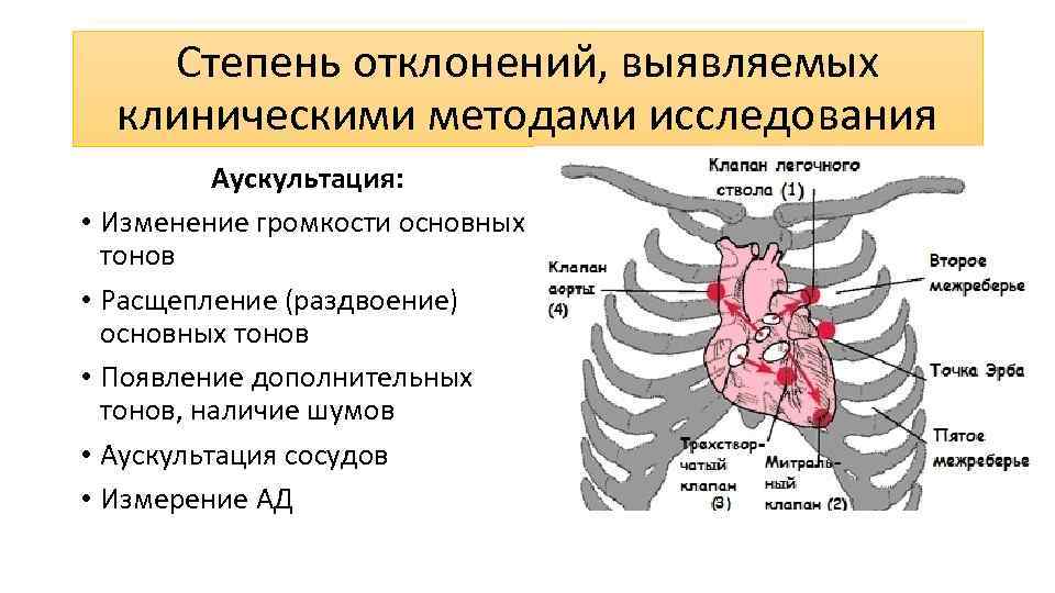 Степень отклонений, выявляемых клиническими методами исследования Аускультация: • Изменение громкости основных тонов • Расщепление