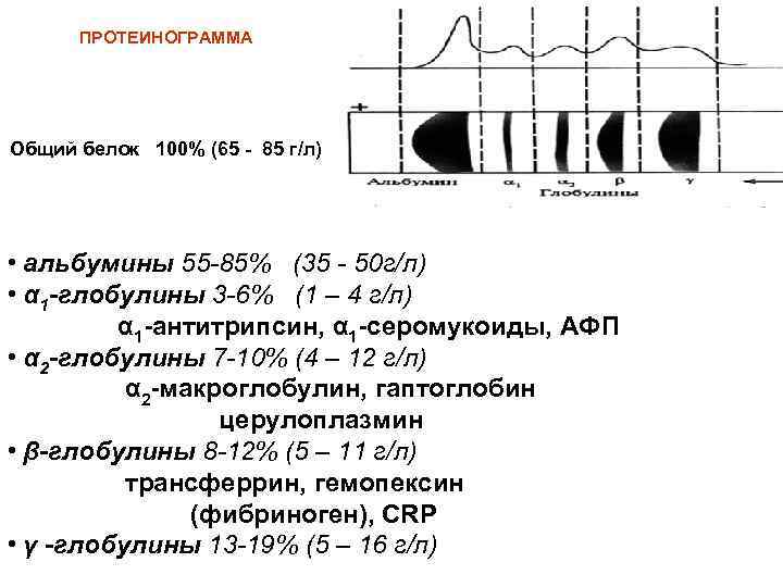 ПРОТЕИНОГРАММА Общий белок 100% (65 - 85 г/л) • альбумины 55 -85% (35 -