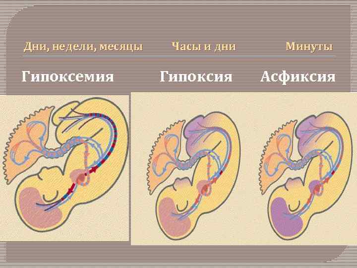 Дни, недели, месяцы Гипоксемия Часы и дни Гипоксия Минуты Асфиксия 