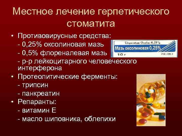 Местное лечение герпетического стоматита • Противовирусные средства: - 0, 25% оксолиновая мазь - 0,